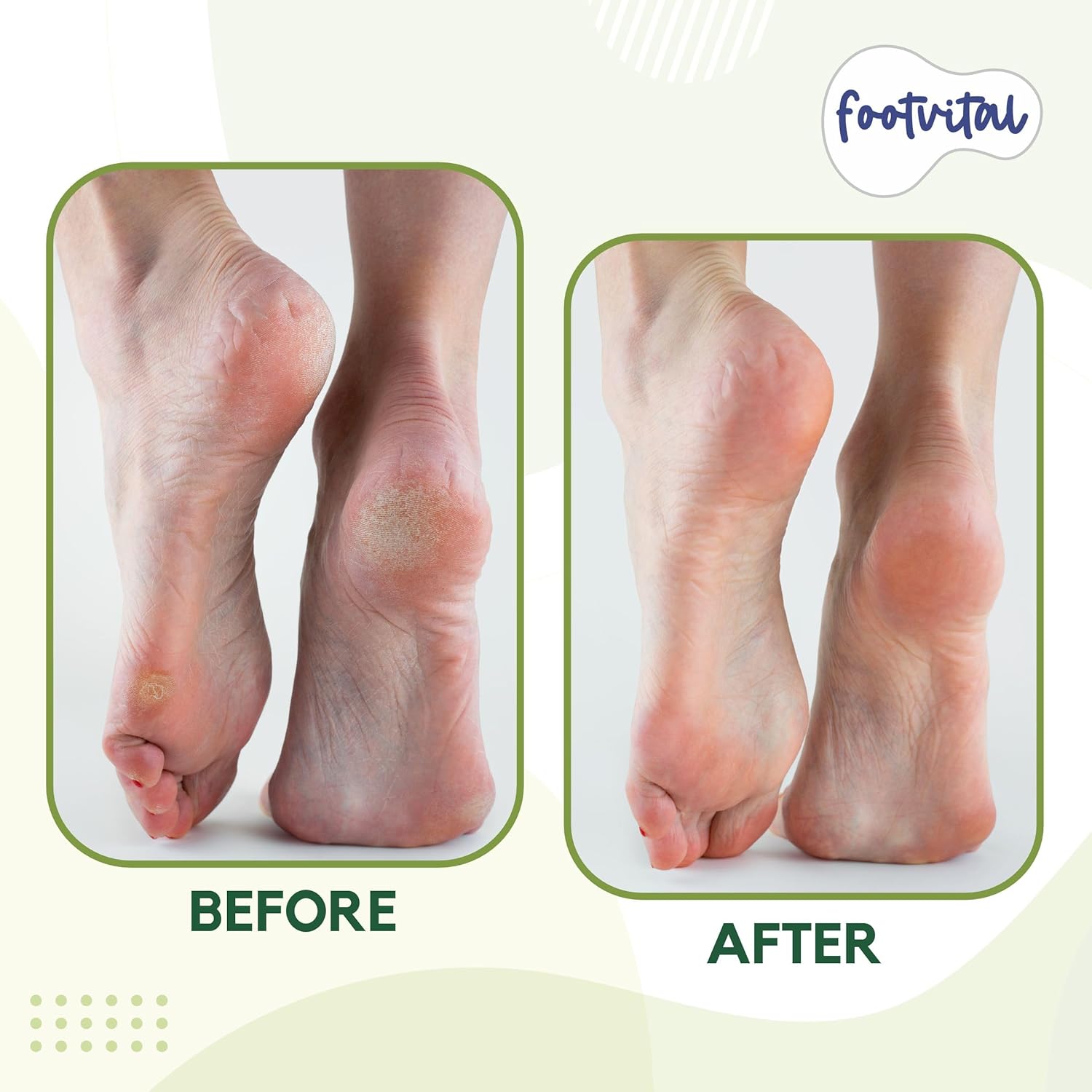 Shoprythm foot Vital Footvital Foot Scrubber Shoprythm foot Vital Footvital Foot Scrubber